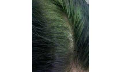 白髪が緑に染まるイメージ